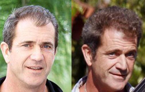 Celbrity Hair Restoration helps extend their youthful appearance - Actor, Mel Gibson