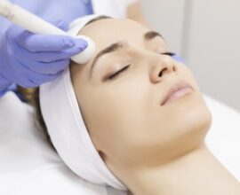 Clear acne scars with laser treatment