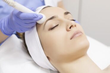 Clear acne scars with laser treatment